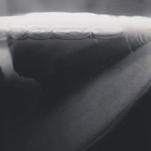 SCOBY, SCOBY & Kulturen dazwischen